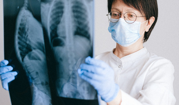 Een dokter met een mondkapje op die een röntgenscan voor zich houd